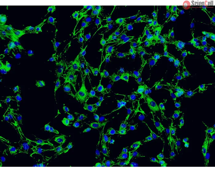 2730 Immunostaining FN 200x
