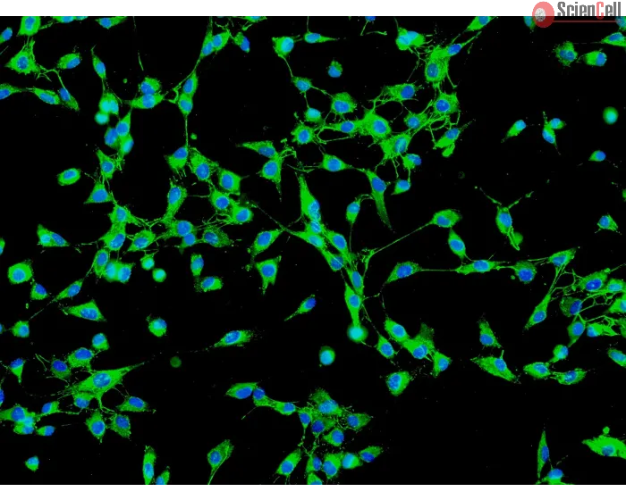 Human Gallbladder Fibroblasts (HGBF) - Immunostaining for Fibronectin, 200x.
