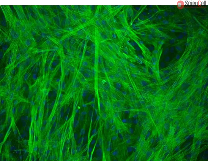 Human Gastric Smooth Muscle Cells (HGSMC) - Immunostaining for α-SMA, 200x.
