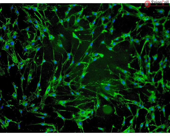 Human Hair Dermal Papilla Cells (HHDPC) - Immunostaining for Fibronectin, 100x.
