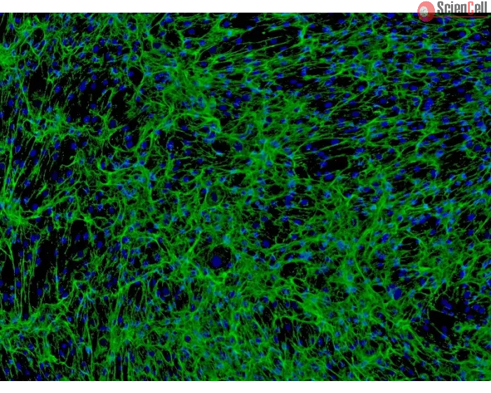 Human Hair Outer Root Sheath Cells (HHORSC) - Immunostaining for Fibronectin, 100x.
