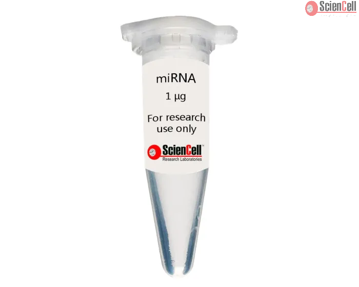 Human Hepatic Sinusoidal Endothelial Cell MicroRNA