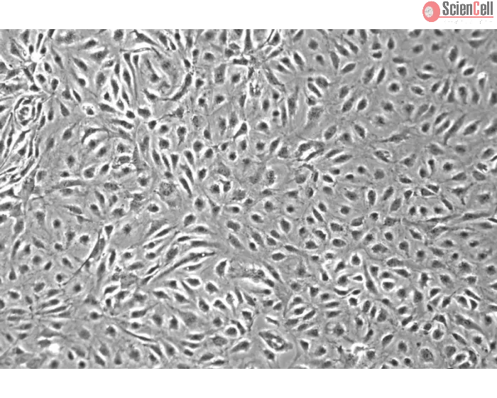 Human Intestinal Microvascular Endothelial Cells (HIMEC) - Phase contrast, 100x.
