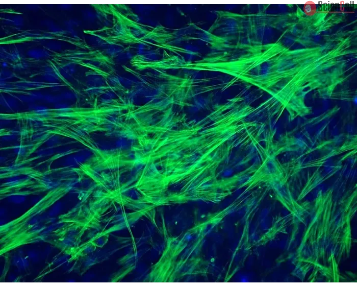 Human Intestinal Smooth Muscle Cells (HISMC) - Immunostaining for α-SMA, 200x.
