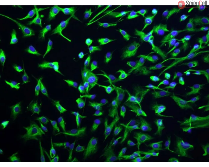 Human Intrahepatic Biliary Epithelial Cells (HIBEpiC)-Immunostaining for CK-18 (Sigma -Aldrich, Cat. #C1399), 200x.
