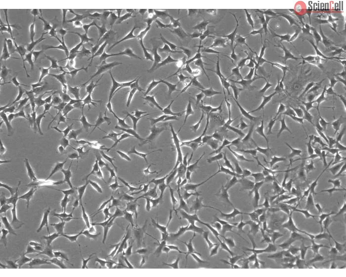 Human Iris Fibroblasts (HIrF) - Phase Contrast, 100X
