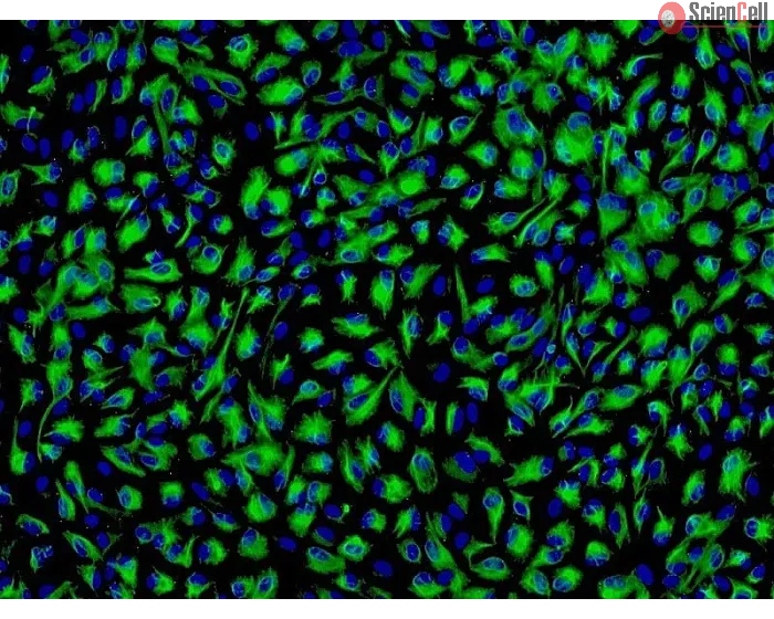 Human Iris Pigment Epithelial Cells (HIPEpiC) - Immunostaining for CK-18, 200x.
