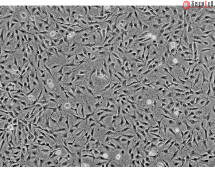 Human Keratocytes (HK) - Phase contrast, 100x.
