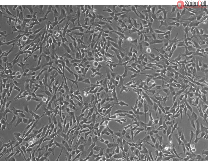 Human Leptomeningeal Pericytes (HLP) – Phase contrast, 100x
