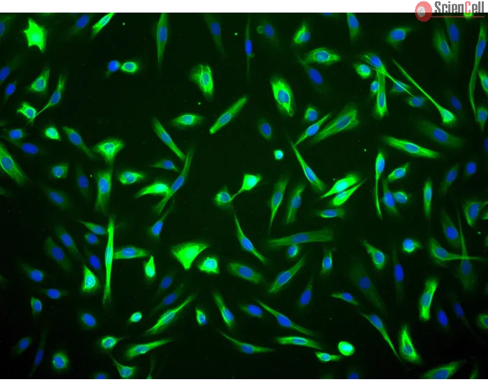 Human Mammary Epithelial Cells (HMEpiC) - Immunostaining for CK-18, 200x.
