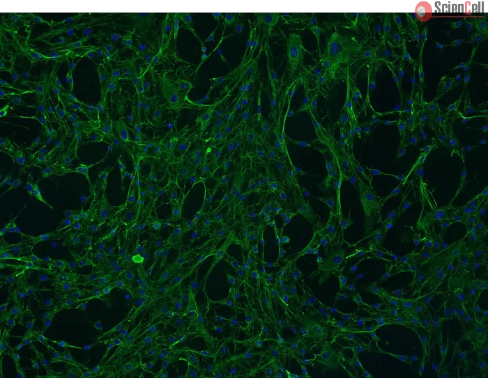 Human Mammary Fibroblasts (HMF) - Immunostaining for Fibronectin, 100x
