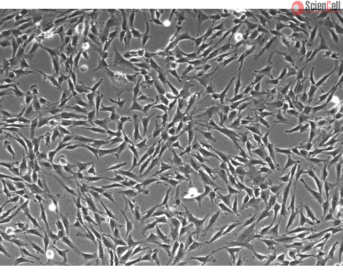 Human Mesenteric Fibroblasts (HMeF)-Phase Contrast, 100x
