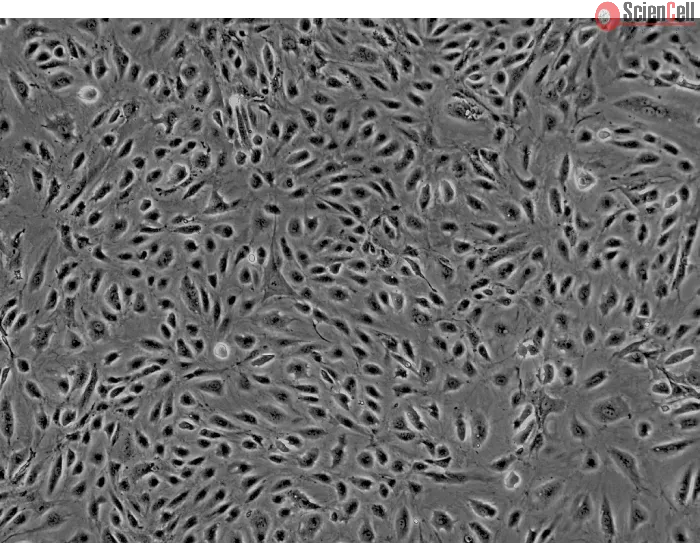 Human Myometrial Microvascular Endothelial Cells (HMMEC)-Phase Contrast, 200x.
