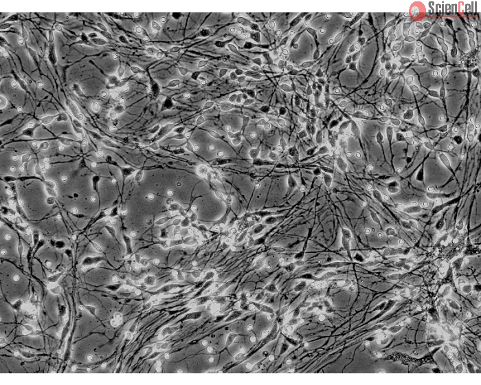 Human Neurons-hippocampal (HN-h) - Phase contrast, 200x.
