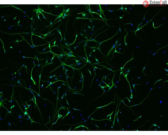 Human Neurons HN - immunostained for beta tubulin III (green), 200x
