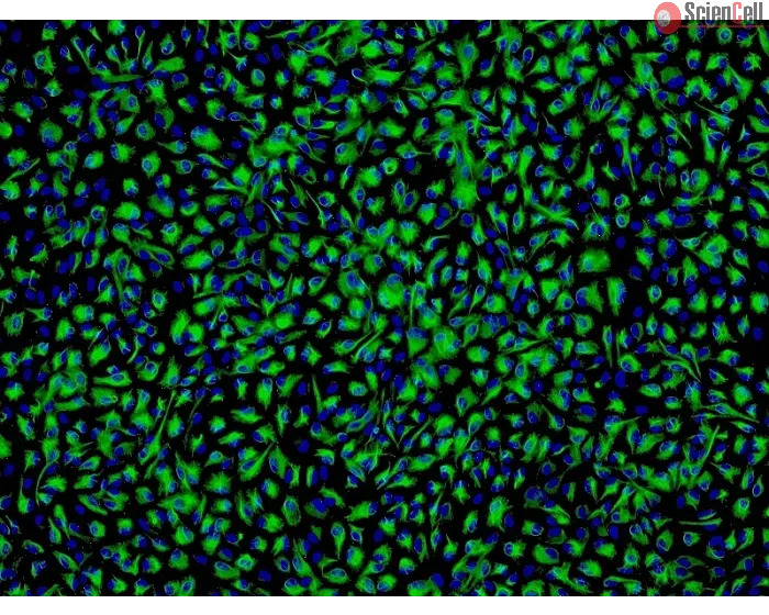 Human Non-Pigment Ciliary Epithelial Cells (HNPCEpiC) - Immunostaining for CK-18, 100x.
