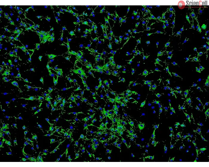 Human Ocular Choroid Fibroblasts (HOCF) - Immunostaining for Fibronectin, 100x.
