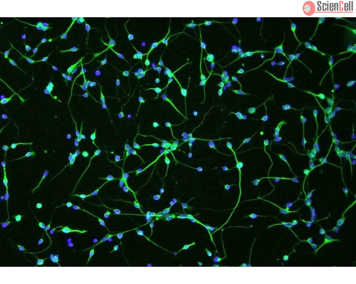 Human Oligodendrocyte Precursor Cells (HOPC) - Immunostaining for A2B5, 100x.
