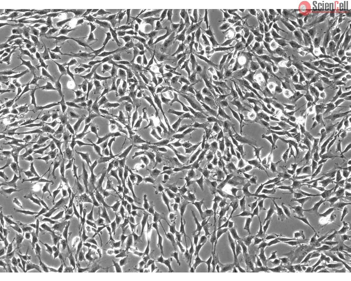 Human Oral Fibroblasts (HOrF) – Phase Contrast, 100x
