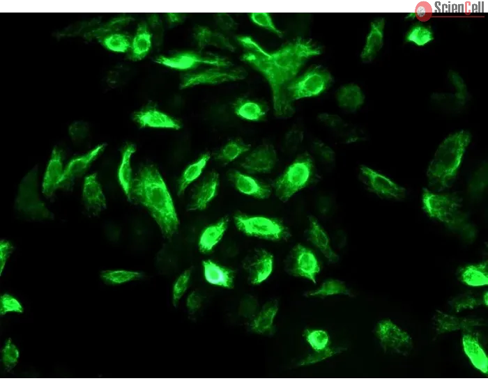 Human Oral Keratinocytes (HOK) - Immunostaining for CK-19, 400x.
