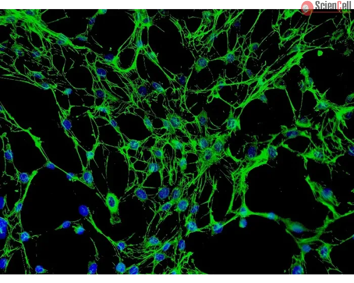 Human Osteoblasts-femoral (HO-f) - Immunostaining for Fibronectin, 200x.
