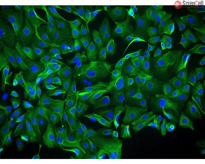 Human Ovarian Surface Epithelial Cells (HOSEpiC) - Immunostaining for CK-18, 400x.
