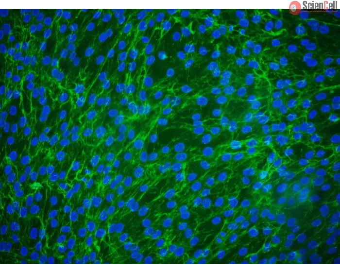 Human Peridontal Ligament Fibroblasts (HPLF) - Immunostaining for Fibronectin, 200x.
