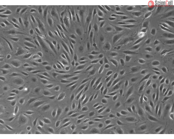 Human Placental Vascular Endothelial Cells (HPVEC) – Phase Contrast, 100x
