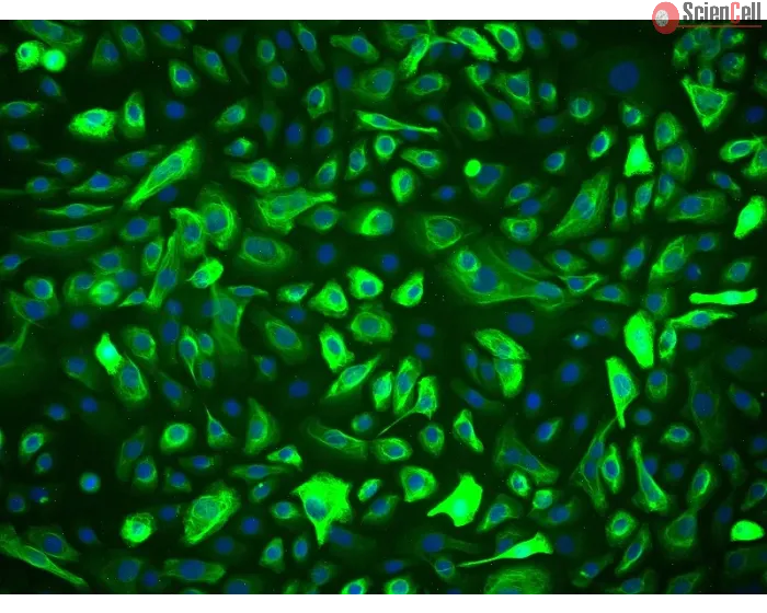 Human Prostate Epithelial Cells (HPrEpiC) - Immunostaining for CK-18, 200x.
