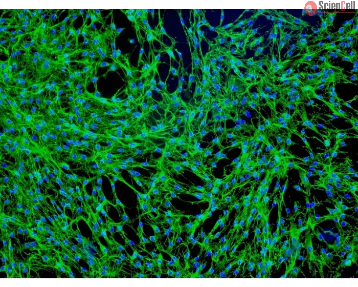 Human Prostate Fibroblasts (HPrF) - Immunostaining for Fibronectin, 100x.