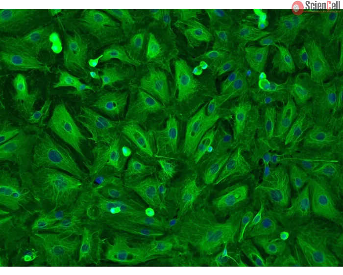 Human Pulmonary Alveolar Epithelial Cells-adult (HPAEpiC-a) - Immunostaining for CK-18 200x