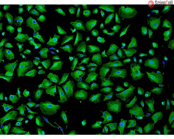 Human Pulmonary Alveolar Epithelial Cells (HPAEpiC) - Immunostaining for CK-18, 100x.
