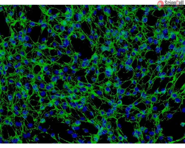 Human Pulmonary Artery Adventitia Fibroblasts (HPAAF) - Immunostaining for Fibronectin, 200x.
