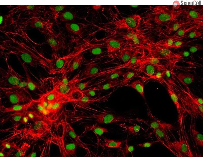 Human Pulmonary Fibroblasts-adult (HPF) - Immunostaining for Fibronectin, 200x.
