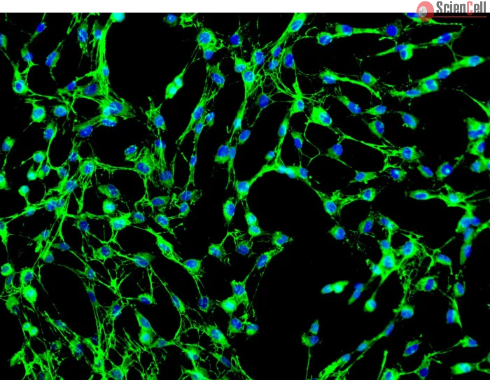 Human Pulmonary Fibroblasts (HPF) - Immunostaining for Fibronectin, 200x.
