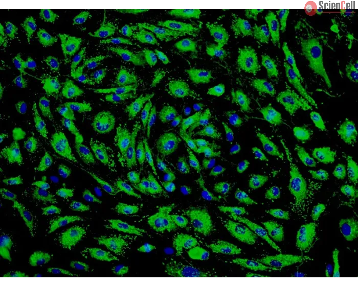 Human Pulmonary Microvascular Endothelial Cells (HPMEC) - Immunostaining for vWF, 200x.
