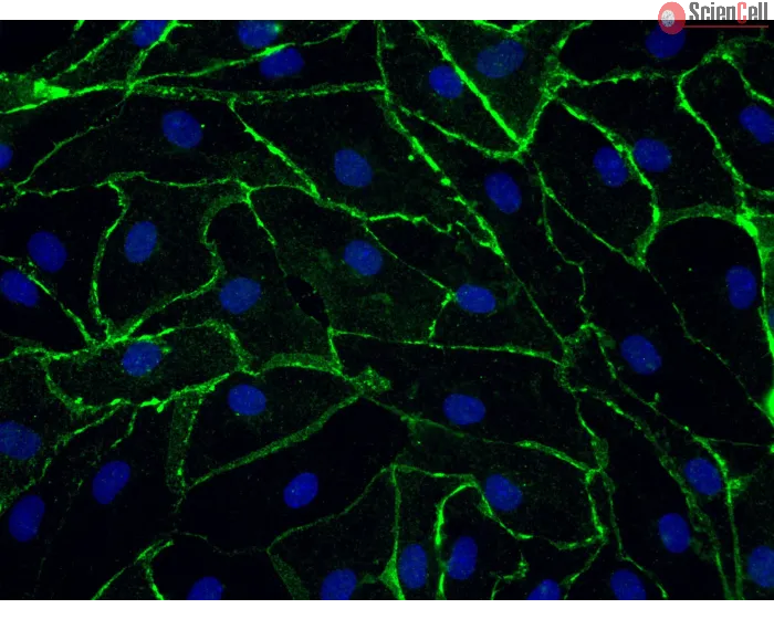 Human Rectal Microvascular Endothelial Cells (HRecMEC), Immunostaining for CD-31, 400x.
