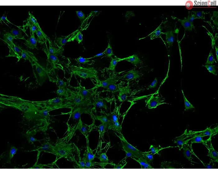 Human Renal Mesangial Cells (HRMC) - Immunostaining for Fibronectin, 200x.