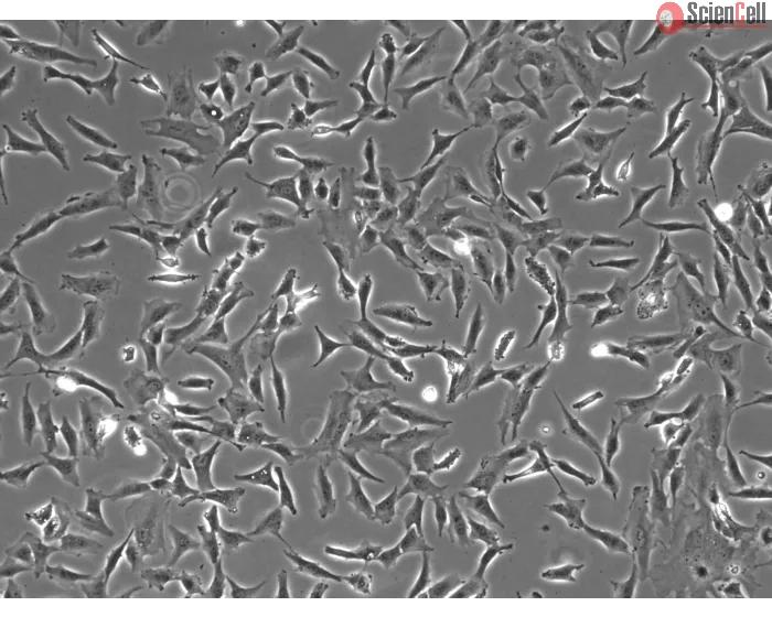 Human Retinal Astrocytes (HRA) - Phase contrast, 100x.
