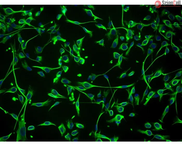 Human Schwann Cells (HSC) - Immunostaining for S100-β, 200x.
