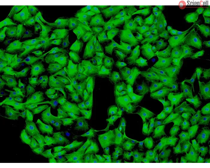 Human Seminal Vesicle Epithelial Cells (HSVEpiC) - Immunostaining for CK-18, 100x.
