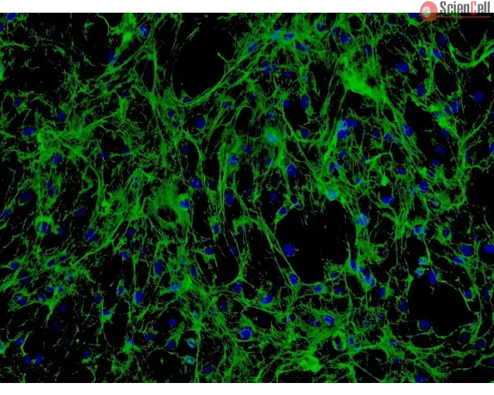 Human Seminal Vesicle Fibroblasts (HSVF) - Immunostaining for Fibronectin, 200x.
