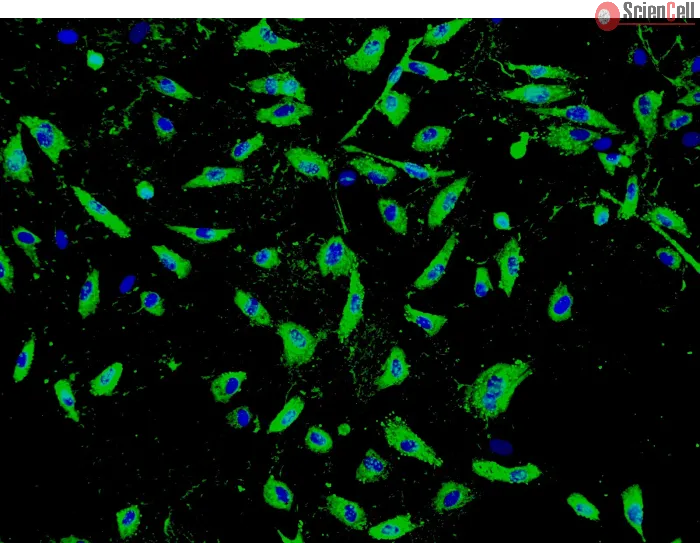 Human Seminal Vesicle Microvascular Endothelial Cells (HSVMEC) - Immunostaining for vWF, 100x.
