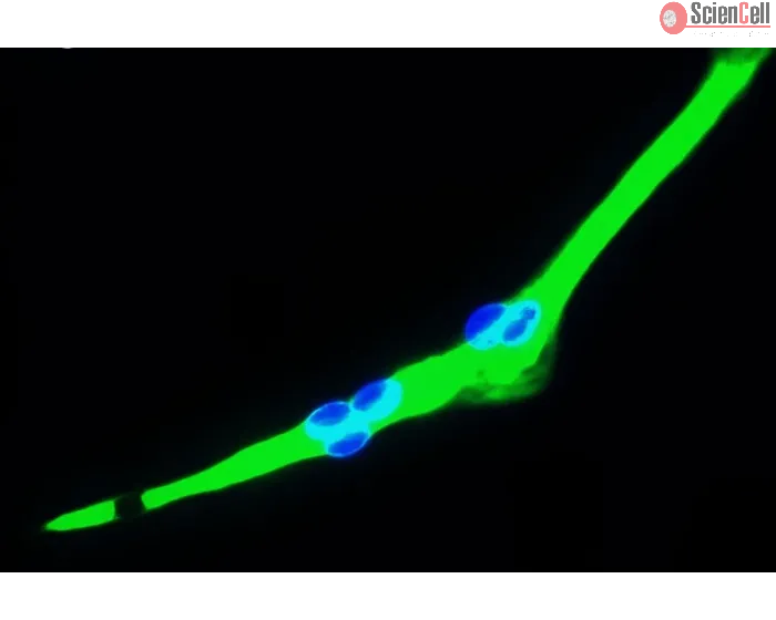 Human Skeletal Muscle Cells (HSkMC) - Immunostaining for Myosin, 400x.
