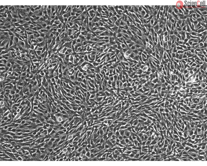 HUMAN SKELETAL MUSCLE MYOBLASTS (HSkMM)- phase contrast 100X
