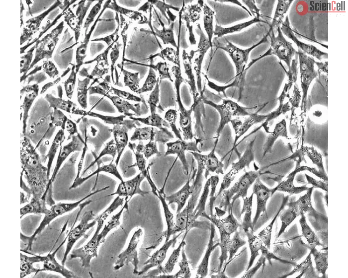 Human Skeletal Muscle Satellite Cells (HSkMSC) - Phase contrast, 200x.
