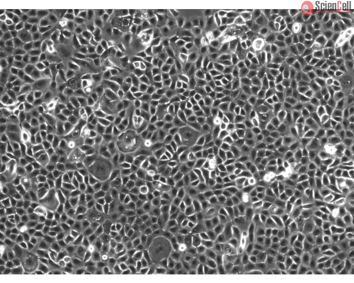 Human Small Airway Epithelial Cells-adult (HSAEpiC-a) - Phase contrast 100x