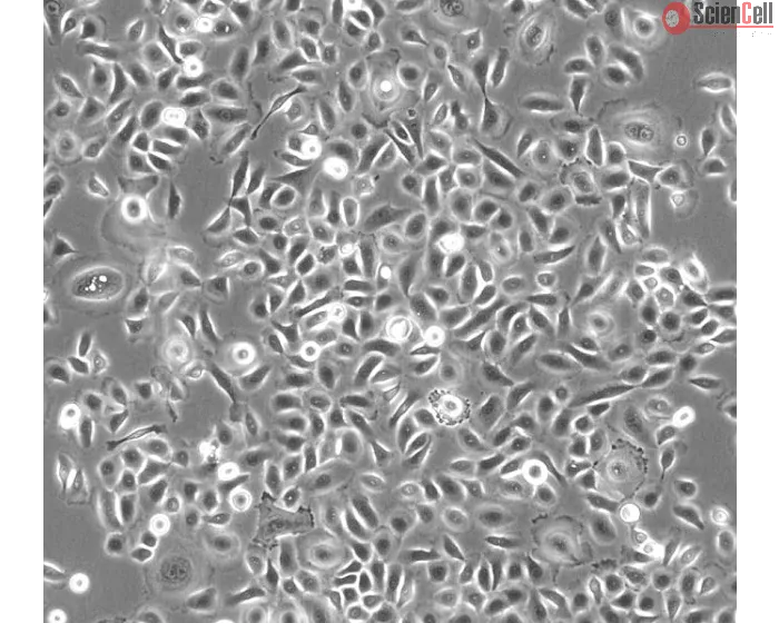 Human Small Airway Epithelial Cells (HSAEpiC) - Phase contrast 100x