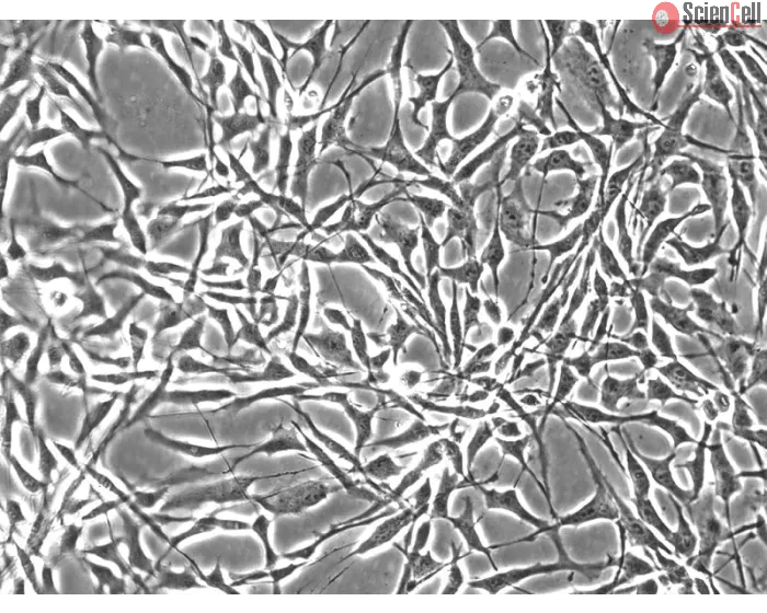 Human Synoviocytes (HS) - Phase contrast, 200x.
