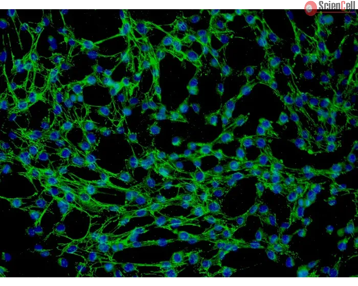 Human Thymic Fibroblasts (HTyF) - Immunostaining for Fibronectin, 200x.
